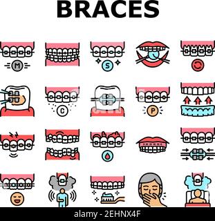 Tooth Braces Accessory Collection Icons Set Vector Stock Vector Image ...
