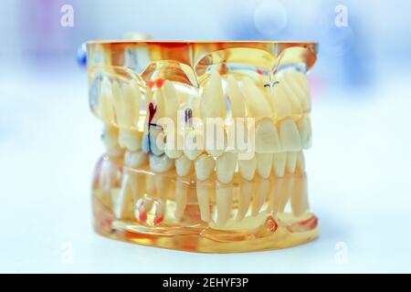 A Transparent Dentures of Human Teeth Anatomy Stock Photo