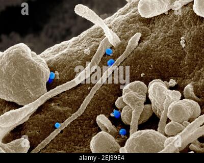 Crimean-congo hemorrhagic fever (cchf) virus Stock Photo