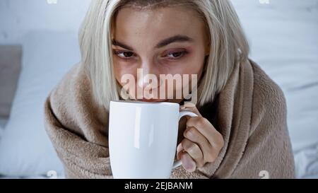 young diseased woman drinking warm beverage in bedroom Stock Photo