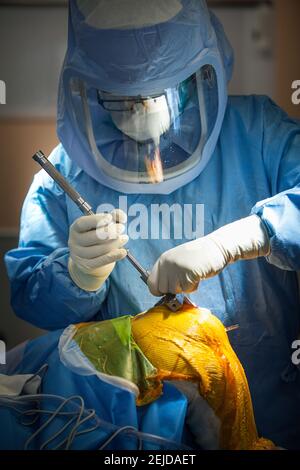 Orthopedic surgery for a total knee replacement. Stock Photo