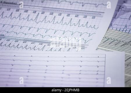 Tracing of electrocardiograms on graph paper. Records of heart activity. Heartbeat with arrhythmia. Selective focus with a portion out of focus. Stock Photo