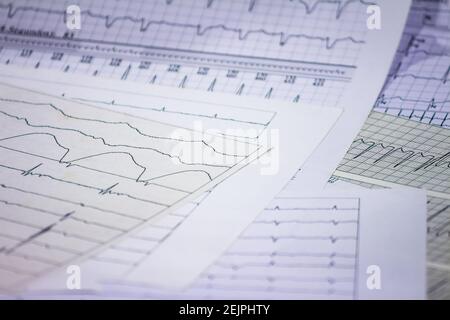 Tracing of electrocardiograms on graph paper. Records of heart activity. Heartbeat with arrhythmia. Selective focus with a portion out of focus. Stock Photo