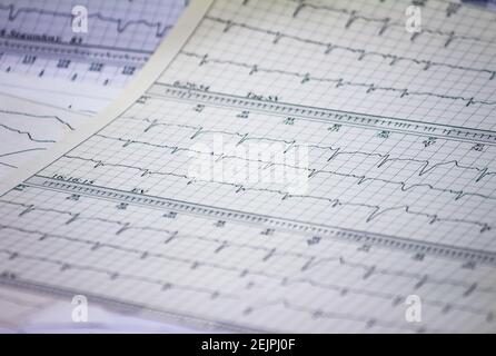 Tracing of electrocardiograms on graph paper. Records of heart activity. Heartbeat with arrhythmia. Selective focus with a portion out of focus. Stock Photo