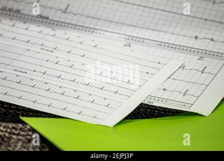 Tracing of electrocardiograms on graph paper. Records of heart activity. Heartbeat with arrhythmia. Selective focus with a portion out of focus. Stock Photo