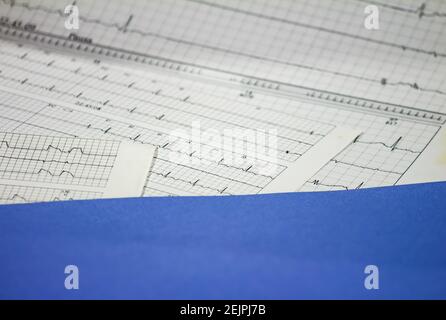 Tracing of electrocardiograms on graph paper. Records of heart activity. Heartbeat with arrhythmia. Selective focus with a portion out of focus. Stock Photo