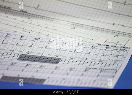 Tracing of electrocardiograms on graph paper. Records of heart activity. Heartbeat with arrhythmia. Selective focus with a portion out of focus. Stock Photo