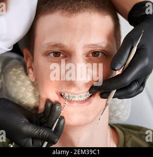 Top view on young man's face in dentist's chair during stomatological procedure. Macro photography of dental braces. Doctor's hands in gloves holding dental tools, putting on rubber bands on brackets Stock Photo