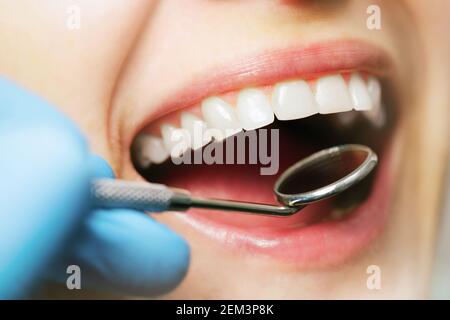 mouth checkup oral hygiene. white healthy woman teeth and dentist mirror. closeup Stock Photo