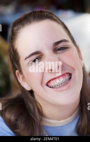 Portrait of a teenage girl wearing braces Stock Photo