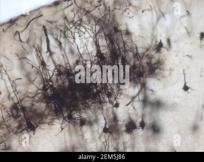 Mouse brain section stained with the Golgi stain, a 19th century technique that was  widely used until recently -  and occasionally still is. Stock Photo