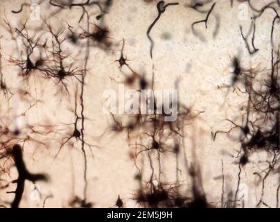 Mouse brain section stained with the Golgi stain, a 19th century technique that was  widely used until recently -  and occasionally still is. Stock Photo