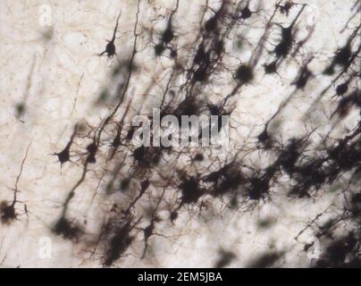 Mouse brain section stained with the Golgi stain, a 19th century technique that was  widely used until recently -  and occasionally still is. Stock Photo