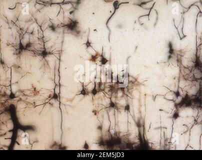 Mouse brain section stained with the Golgi stain, a 19th century technique that was  widely used until recently -  and occasionally still is. Stock Photo