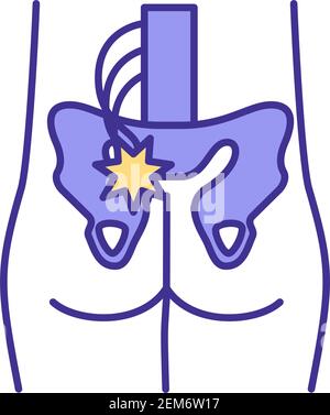 Pinched nerve in hip RGB color icon Stock Vector