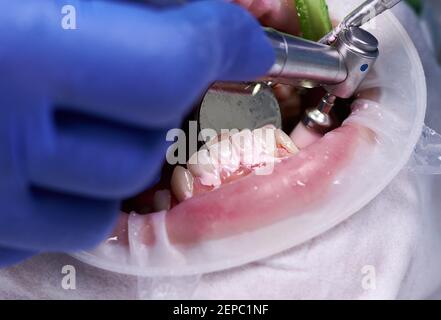 Close up of periodontist using dental polisher and mirror cleaning teeth of patient, with cheek retractor in mouth, polishing in dental clinic. Concept of professional dental hygiene Stock Photo