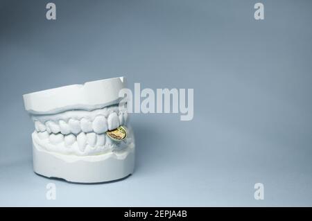 View of the impression of a bit, with the upper and lower jaw in front of a light background. There is still a small gold coin between the pines Stock Photo