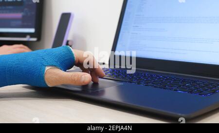 Fiberglass cast hand uses laptop program code Stock Photo