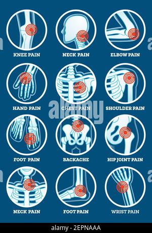 Body Pain Set. Pain in Backache, Hip Joint, Knee, Elbow, Hand, Foot, Shoulder, Neck, Chest and Wrist. Woman's and Man's Body Parts. Vector. Stock Vector