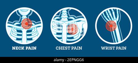 Body Pain. Icons Set. Pain in Neck, Chest and Wrist. Woman's and Man's Body Parts. Vector Illustration. Stock Vector