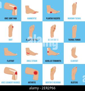 Set of flat icons with foot problems on white blue background isolated vector illustration Stock Vector