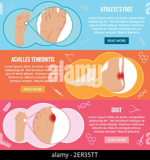 Set of flat horizontal banners wit foot problems isolated on colorful background vector illustration Stock Vector