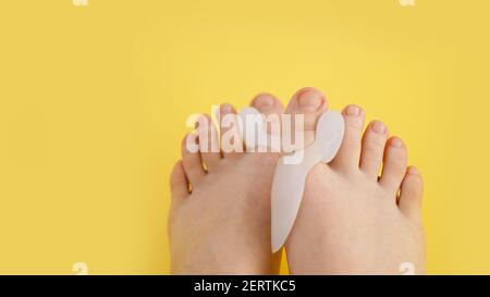 Silicone finger separator. Orthopedic thumb corrector. Legs on a bright yellow background. Stock Photo