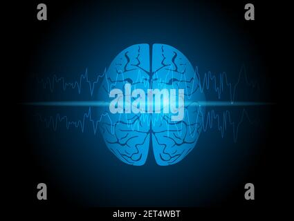 Illustration of human brain with focal seizure showing abnormal sharp wave on electroencephalography or EEG. Stock Vector