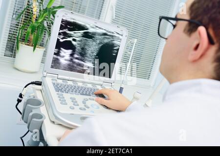 doctor examines the result of an ultrasound examination of the thyroid gland on the monitor. Stock Photo