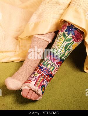 1960s 1970s BROKEN LEG IN COLORFUL PLASTER CAST DECORATED WITH FLOWERS WORD OUCH - ks6101 HAR001 HARS WORD TOES CONCEPTUAL FRACTURED STYLISH SUPPORT IMMOBILE LEFT OUCH HAR001 OLD FASHIONED Stock Photo