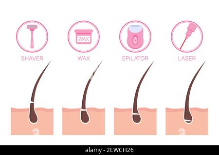 Different methods of hair removal and types of epilation. Flat style vector illustration with copy space for design Stock Vector