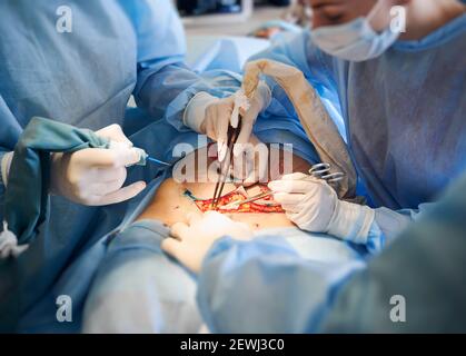 Medical workers in blue surgical uniforms doing plastic surgery in operating room. Plastic surgeon and assistant using medical instruments. Concept of medicine, abdominoplasty and plastic surgery. Stock Photo