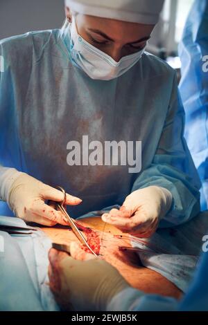 Female surgeon in surgical suit performing tummy tuck surgery in operating room. Doctor wearing medical face mask and sterile gloves while doing abdominal plastic surgery. Concept of abdominoplasty. Stock Photo