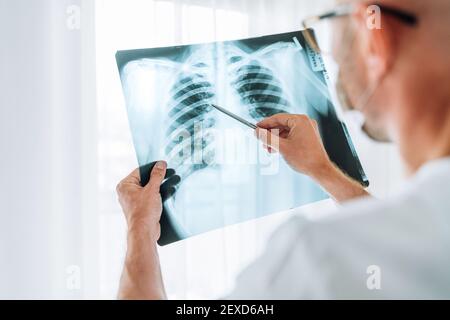 Male doctor examining the patient chest x-ray film lungs scan at radiology department in hospital.Covid-19 scan body xray test detection for covid wor Stock Photo
