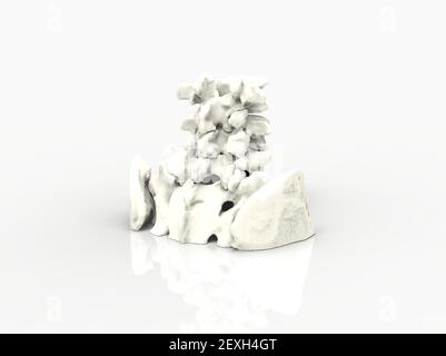 CT scan of Lumbar spine 3D rendering showing Profile Human Spine ...
