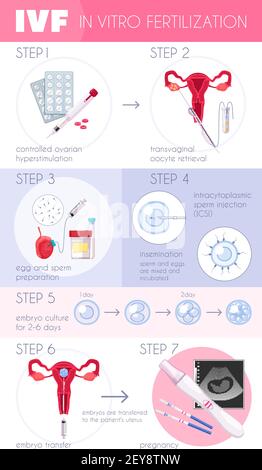 IVF Treatment Steps with In Vitro Fertilization Concept. Vector ...