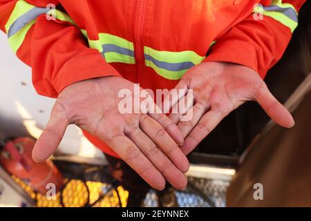 Haikou, China's Hainan Province. 5th Mar, 2021. Tower crane operator Lyu Honghui shows her hands which bear thick calluses accumulated from ladder-climbing at the construction site of a duty-free shopping complex in Haikou, south China's Hainan Province, March 5, 2021. A growing number of women have chosen careers that were traditionally deemed 'masculine'. On China's rising tower cranes, for instance, the female workforce are demonstrating comparative advantages such as patience and meticulousness. Credit: Zhang Liyun/Xinhua/Alamy Live News Stock Photo