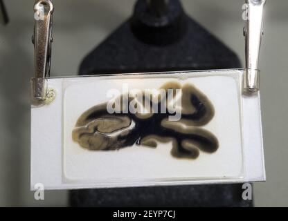 https://l450v.alamy.com/450v/2eyp7cj/a-specimen-of-albert-einsteins-brain-is-on-display-at-the-mutter-museum-of-the-college-of-physicians-of-philadelphia-pennsylvania-we-dont-sugarcoat-or-glorify-anything-says-curator-anna-dhody-we-ask-visitors-to-come-with-open-minds-and-focus-on-the-subjects-that-appeal-to-them-harry-fisherallentown-morning-callmctsipa-usa-2eyp7cj.jpg