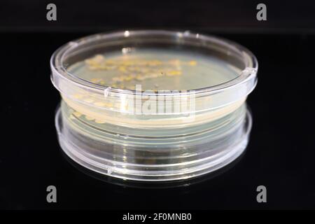 A petri dish with common yeast and bacteria colonies Stock Photo