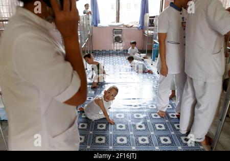 Abandoned Children Suffering From Agent Orange Live At The Lang Hoa Binh Ii Peace Village In Ho Chi Minh City Vietnam Photo By Nhat V Meyer San Jose Mercury News Mct Sipa Usa Stock Photo