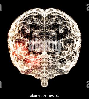 Pain in the head, brain and synapses, cognitive problems, mental deficit. Aneurysm. Degenerative diseases affecting the brain area. Parkinson, stroke Stock Photo