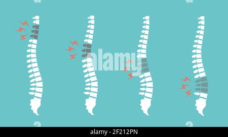 Backache spines set. Back pain vector icon illustration isolated. Damaged Disks Stock Vector