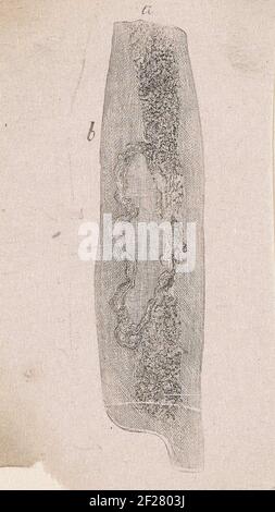 Part of the human body with a deviation Stock Photo - Alamy