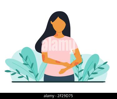 psoriasis or rash icon, skin disease vector Stock Vector Image & Art ...