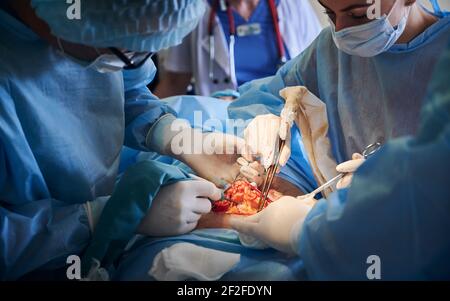 Doctors performing abdominoplasty surgery in operating room. Stock Photo