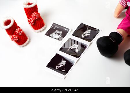 Booties, ultrasound image and a child's toy on a white background, close-up. Concept of family planning and pregnancy. Stock Photo