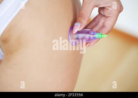 Woman getting anti-cellulite massage of hips with use of vacuum cans Stock Photo