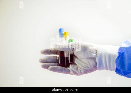 A closeup shot of a doctor's hand holding a blood test full tubes on the white background Stock Photo