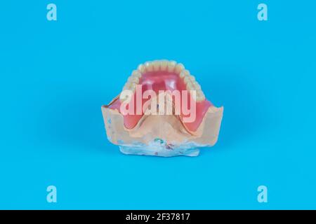 Plaster mock-up of the jaw with gums and teeth on a blue background ...