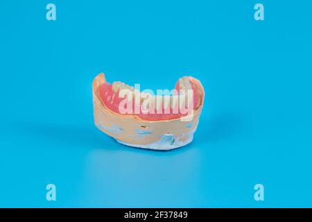 Plaster mock-up of the jaw with gums and teeth on a blue background ...